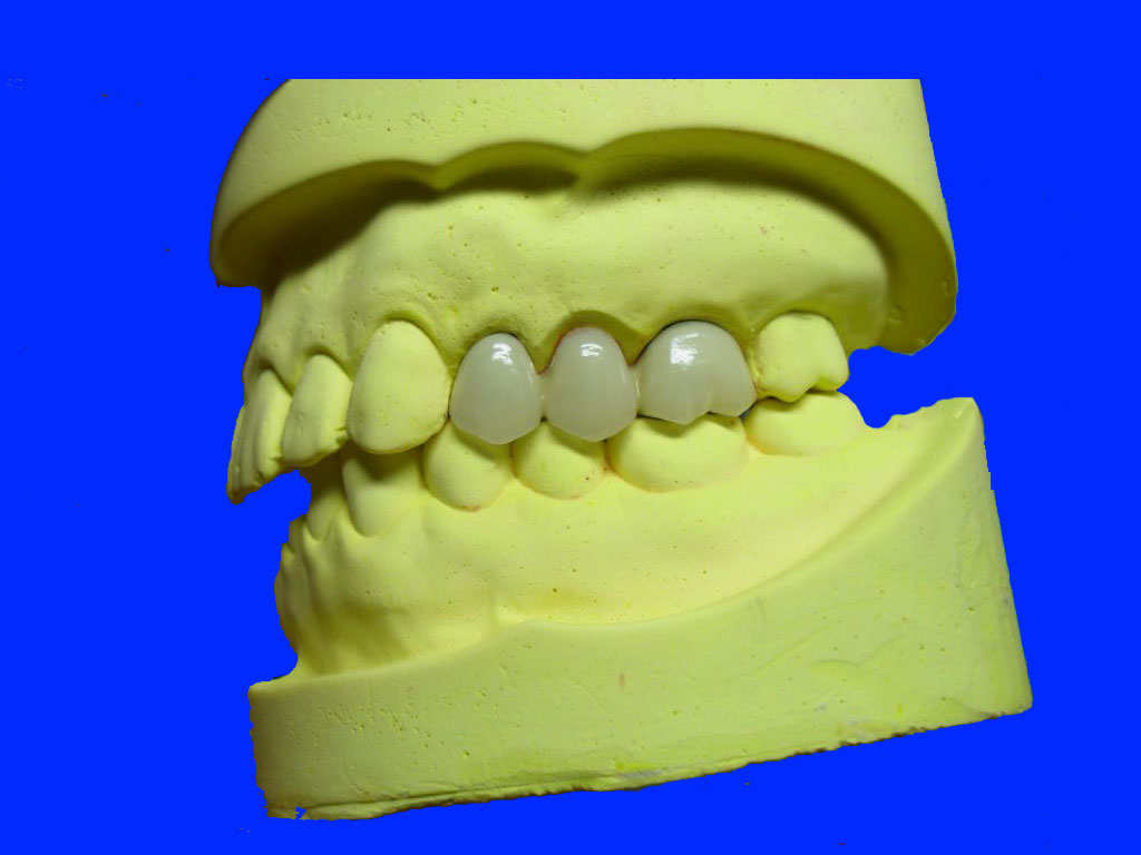 3D